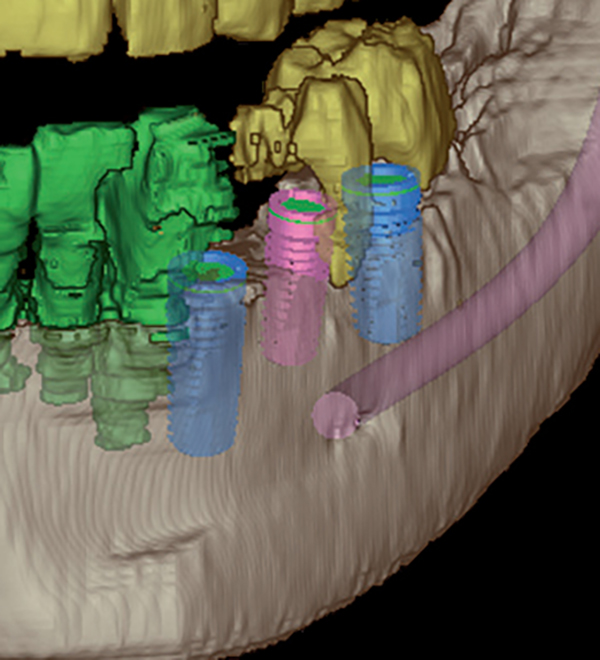 3d Diagnostik